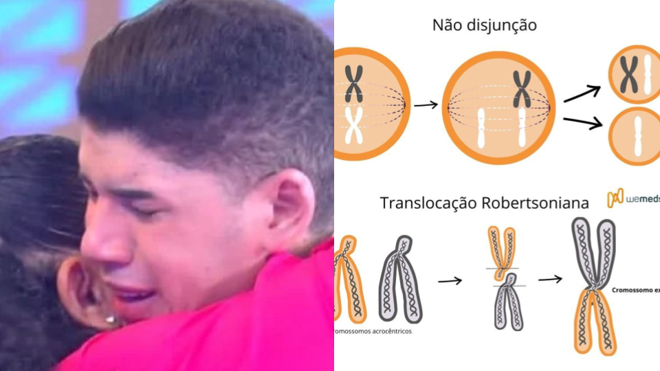 Síndrome de Patau: Conheça a doença que MAT0U o filho do cantor Zé Vaqueiro: “Tome CUIDADO…Ver mais