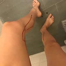 Mulher morre após relação com seu parceiro ele introduziu objeto no…Ver Mais